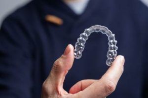 Dentista enseñando cuanto tiempo se usa el invisalign