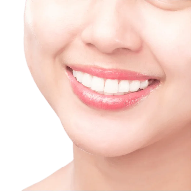 mujer con sonrisa radiante con blanqueamiento