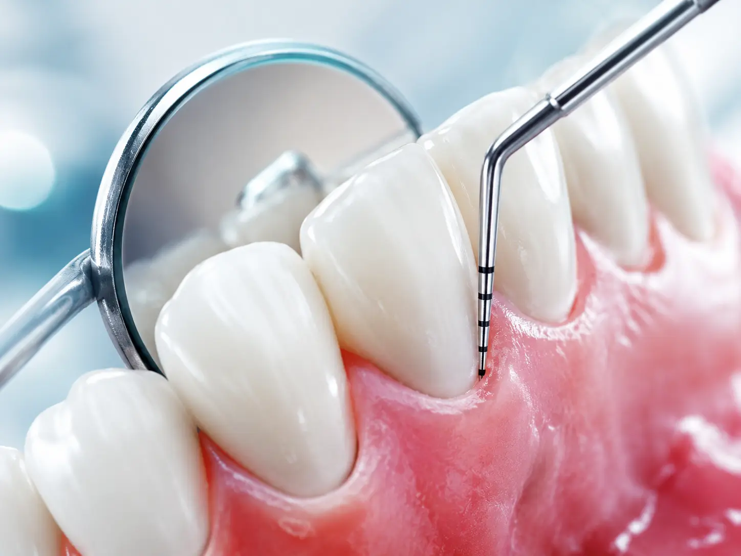Urgencias dentales y dolor de muela en Climedent El Ejido